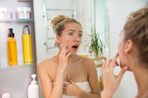 Stress Acne: Causes and Effective Solutions